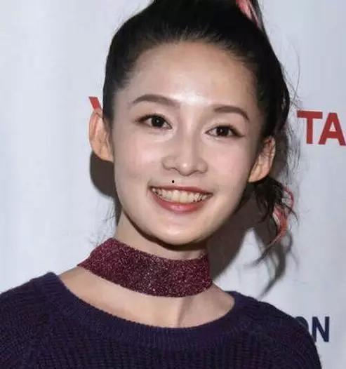 明星满口大黄牙,揭秘满口大黄牙背后的秘密