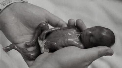 明星早产宝宝都有谁,盘点那些提前来到人间的明星宝宝